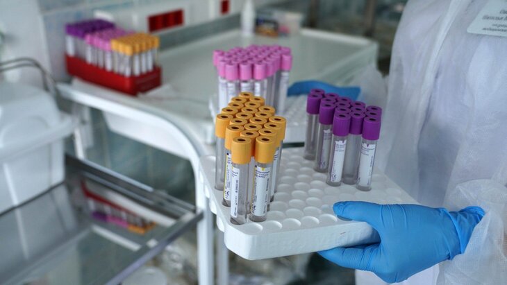 Роспотребнадзор опроверг массовую вспышку вируса Коксаки в РФ