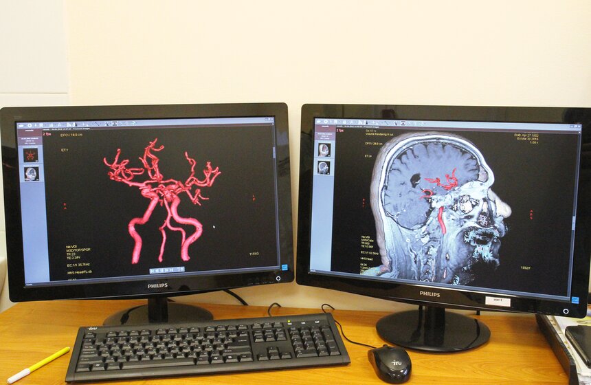 Сергей Собянин посетил Центр радиохирургии НИИ Склифосовского 12 фото