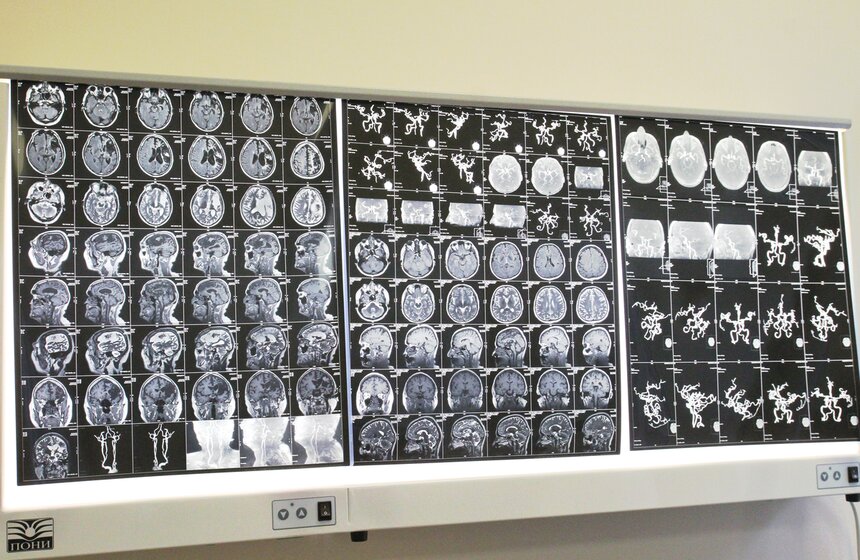 Сергей Собянин посетил Центр радиохирургии НИИ Склифосовского 13 фото