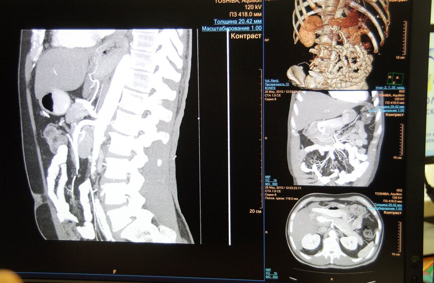 Собянин посетил Научно-практический центр медицинской радиологии 5 фото