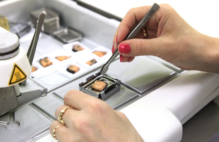 Сергей Собянин ознакомился с новыми технологиями лечения ГКБ №50 5 фото