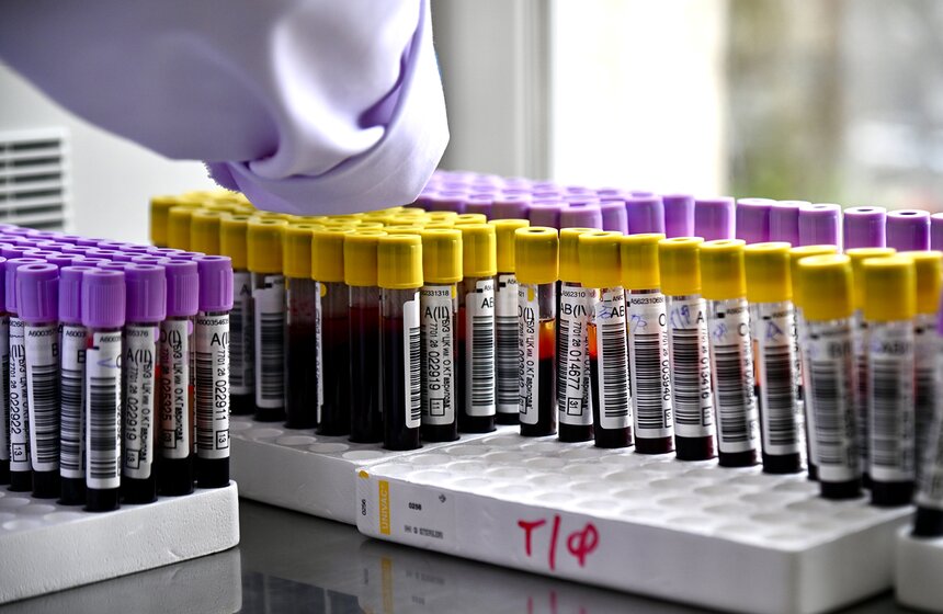 Пресс-тур к Национальному дню донора состоялся в Центре крови имени Гаврилова 2 фото