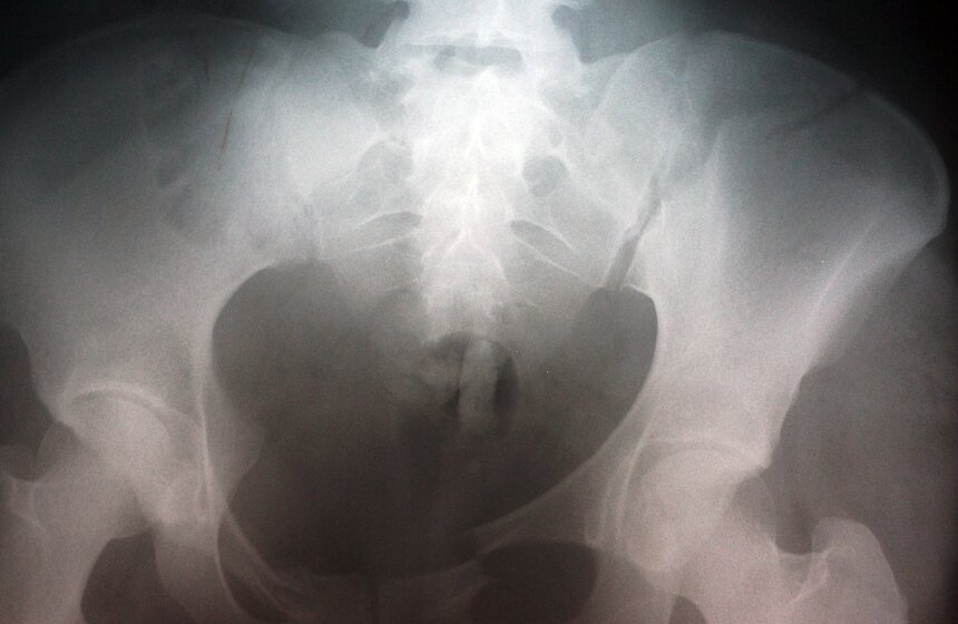 В Боткинской больнице оказывают помощь раненым в крушении поезда 8 фото