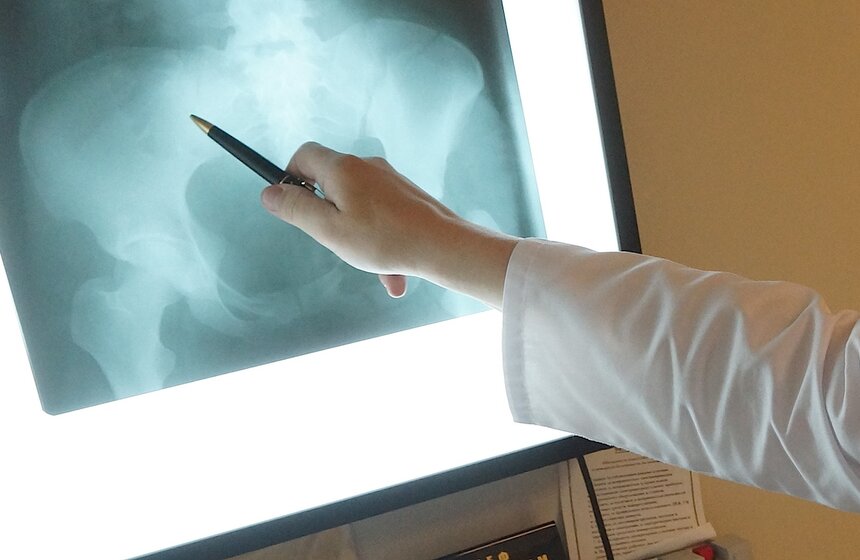 В Боткинской больнице оказывают помощь раненым в крушении поезда 9 фото