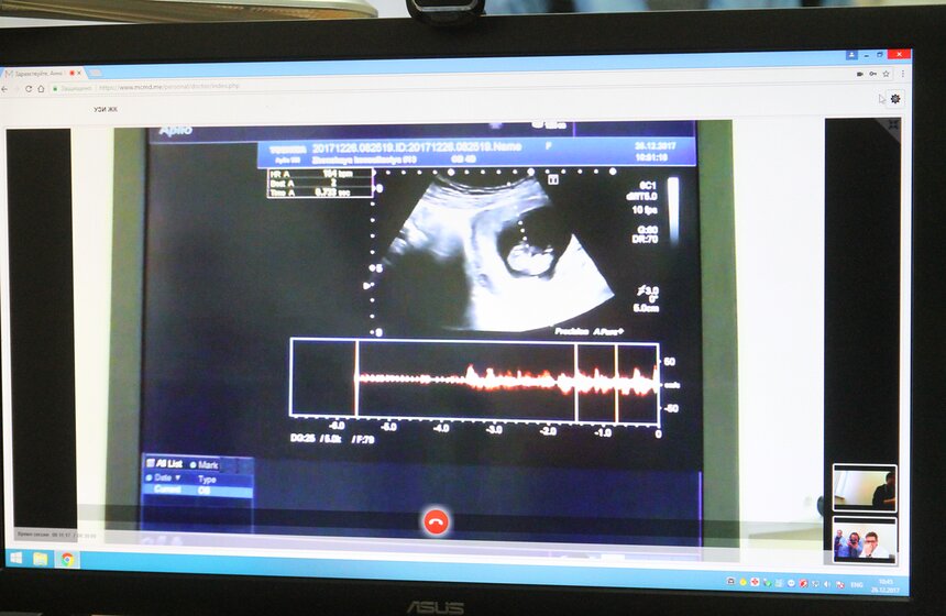 Для выявления врожденной патологии у младенцев проводятся нейросонография, аудиологическое обследование
