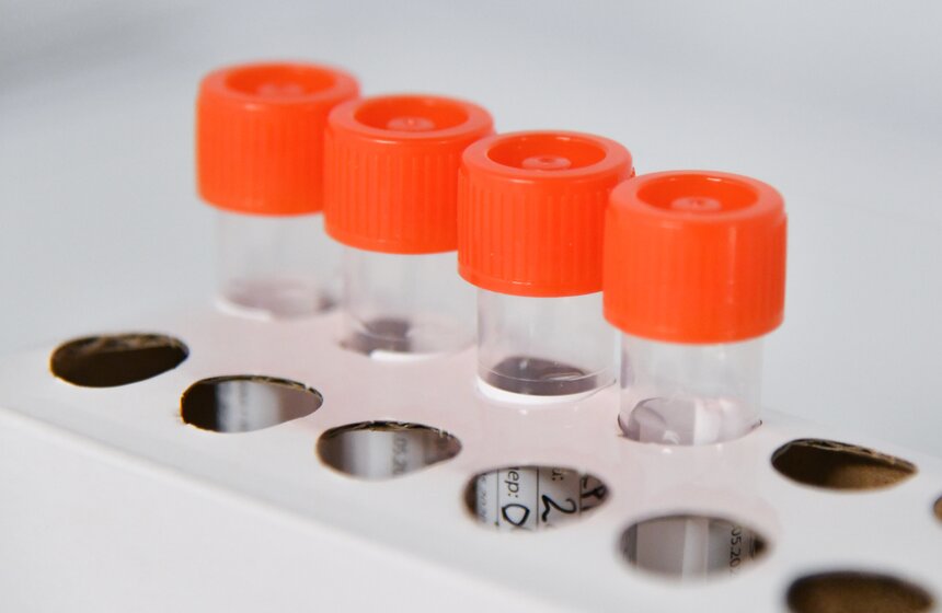 В РФ диагноз будут ставить на основании экспресс-теста на коронавирус 20 фото