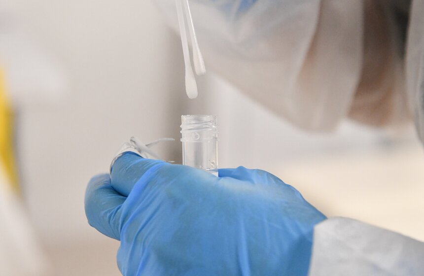 В РФ диагноз будут ставить на основании экспресс-теста на коронавирус 24 фото