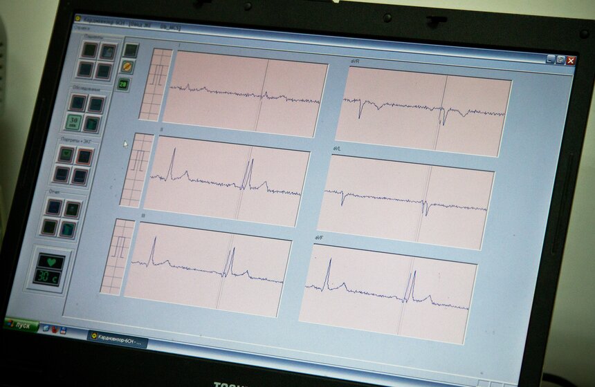 На ВВЦ с 1 по 9 февраля предлагают бесплатно проверить сердце 5 фото