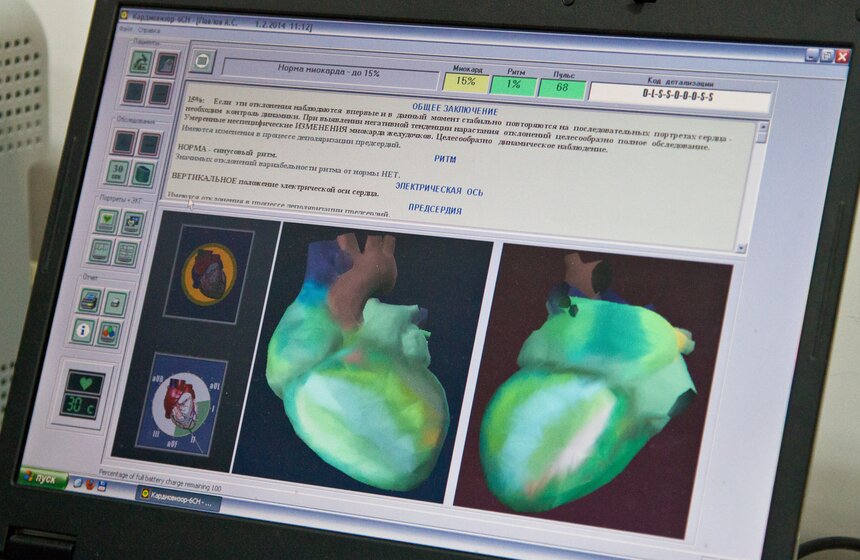 На ВВЦ с 1 по 9 февраля предлагают бесплатно проверить сердце 2 фото