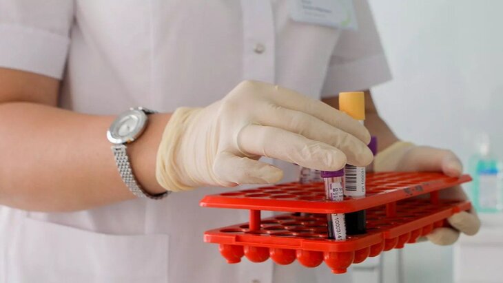 Роспотребнадзор опроверг данные о тестировании прибывших из Чехии на гепатит