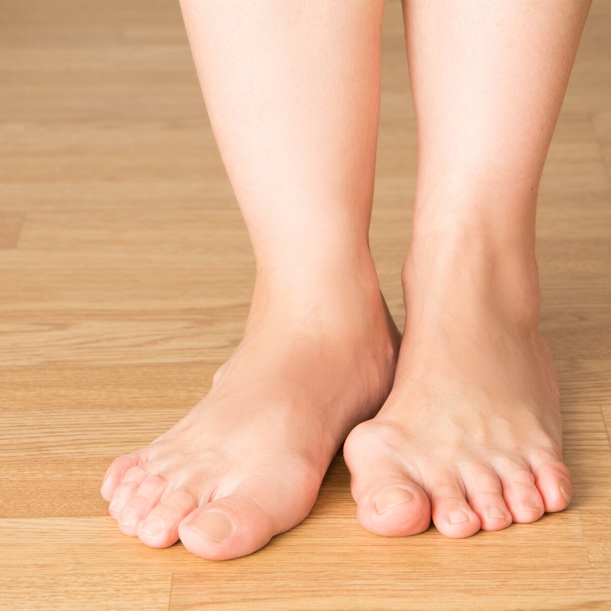 Косточка на большом пальце ноги - лечение и удаление косточек на ногах в клинике СОЮЗ.