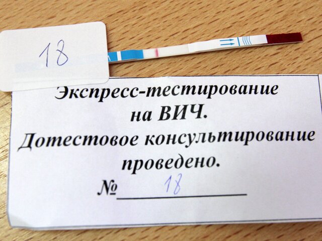 Эпидемиолог: распространенность ВИЧ в Москве в два раза ниже среднего по России