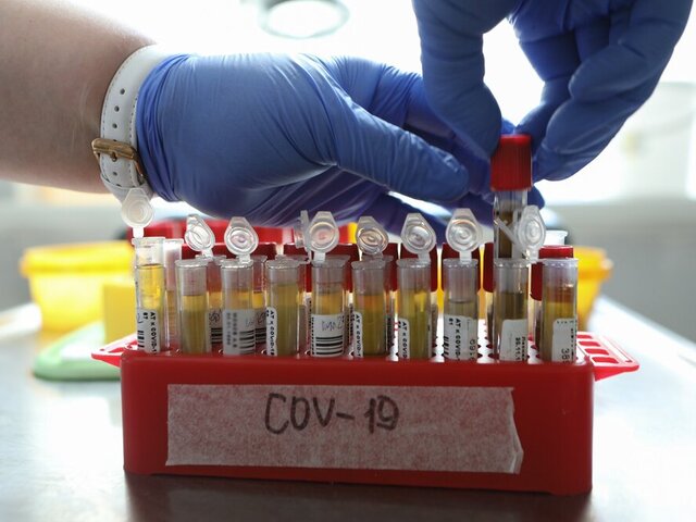 В Москве за сутки выявили 6 149 новых случаев заражения COVID-19