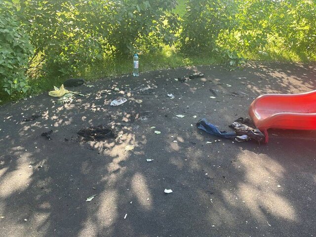 Ребенок получил тяжелые ожоги на детской площадке в Москве